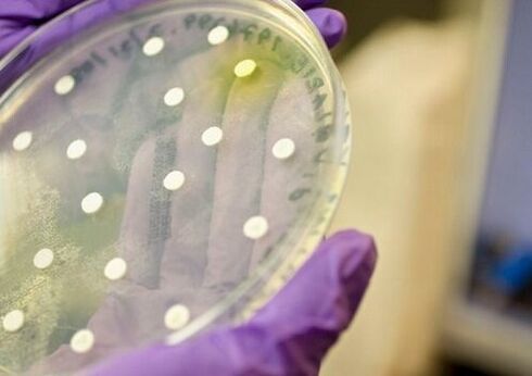 Coltura batterica per la diagnosi di prostatite