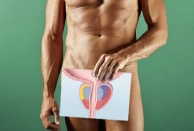 cambiamenti nella prostata con prostatite